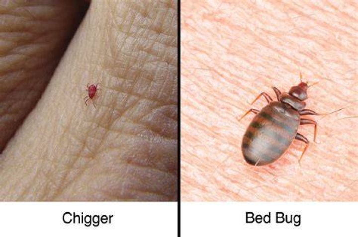 bed bug chiggers