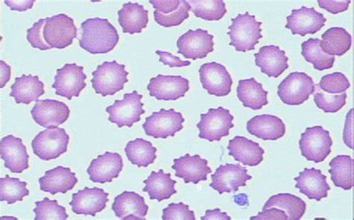 burr cells