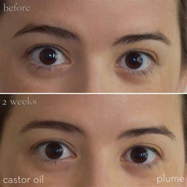 castor oil for eyelashes