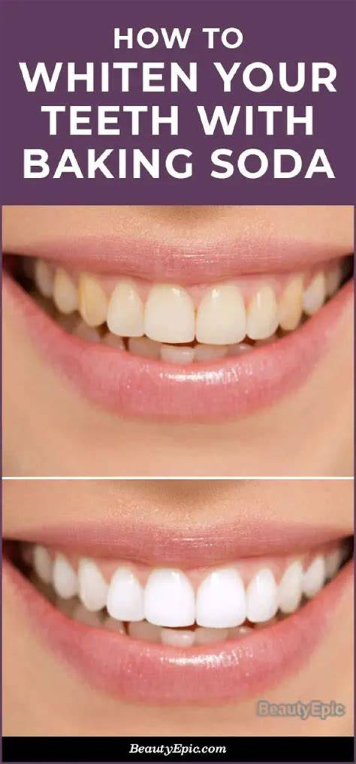 does baking soda whiten teeth