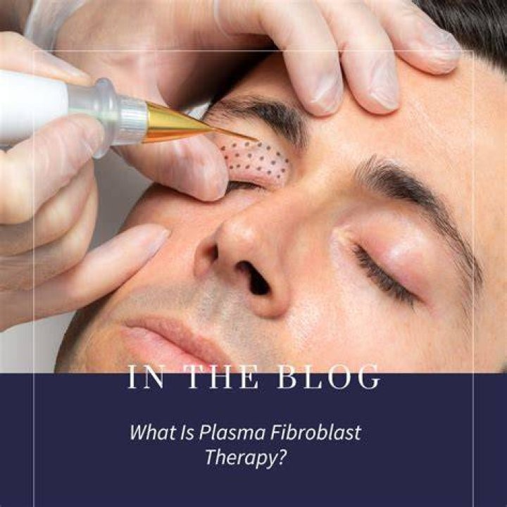 Fibroblast therapy - How To Discuss
