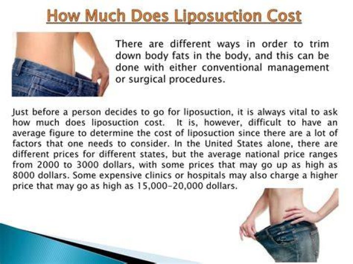 How much is liposuction?